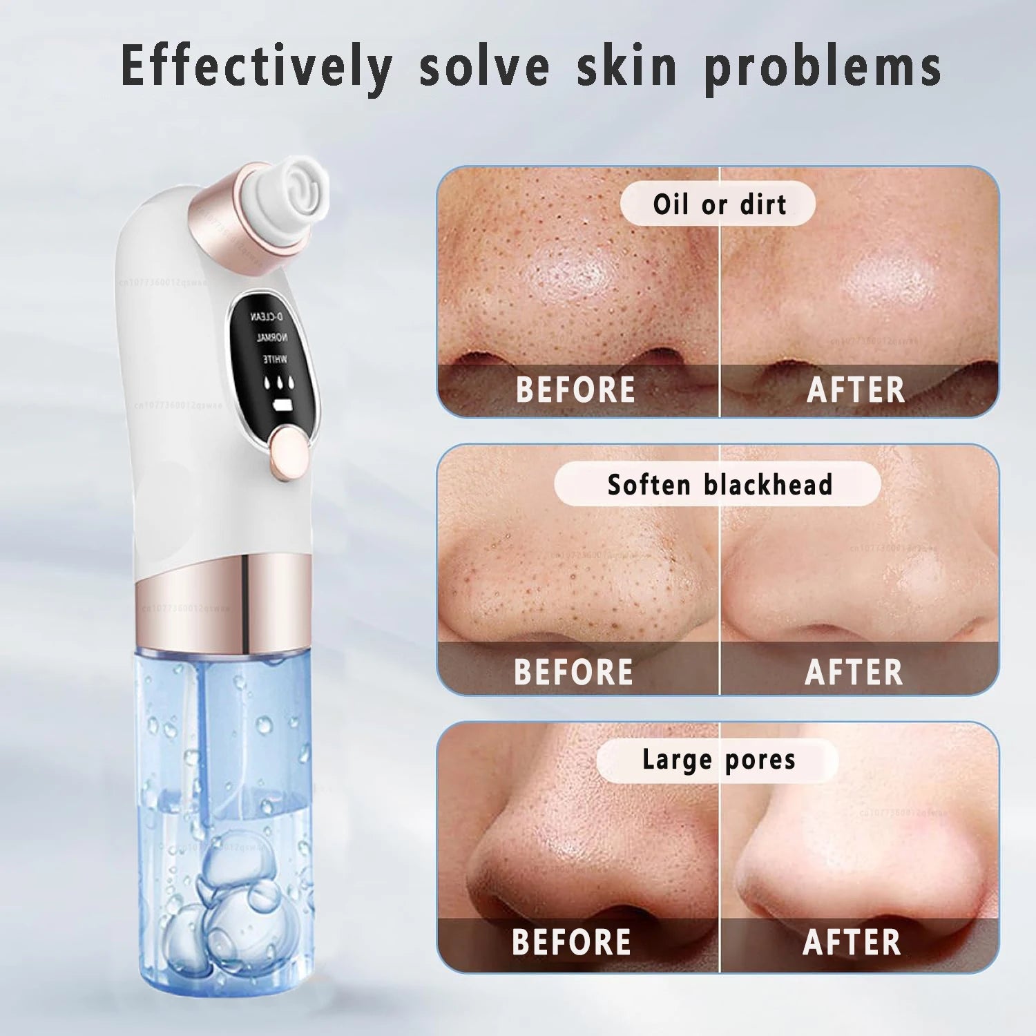 Pore Vacuum Cleaner Blackhead Remover